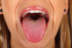 口臭予防になる 舌みがき の正しいやり方 新城パーク歯科クリニック 土日診療 武蔵新城の歯科歯医者